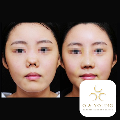 病院 BEAUTY NEWS