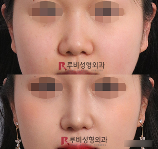전후6