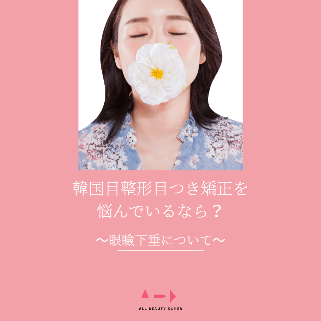 韓国目整形目つき矯正を悩んでいるなら？～眼瞼下垂について～
