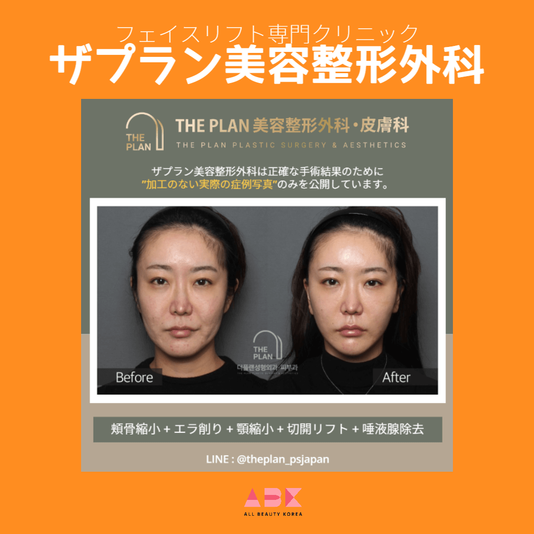 ザプラン美容整形外科, 症例写真