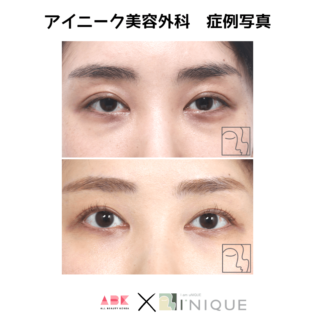 アイニーク美容外科,症例写真