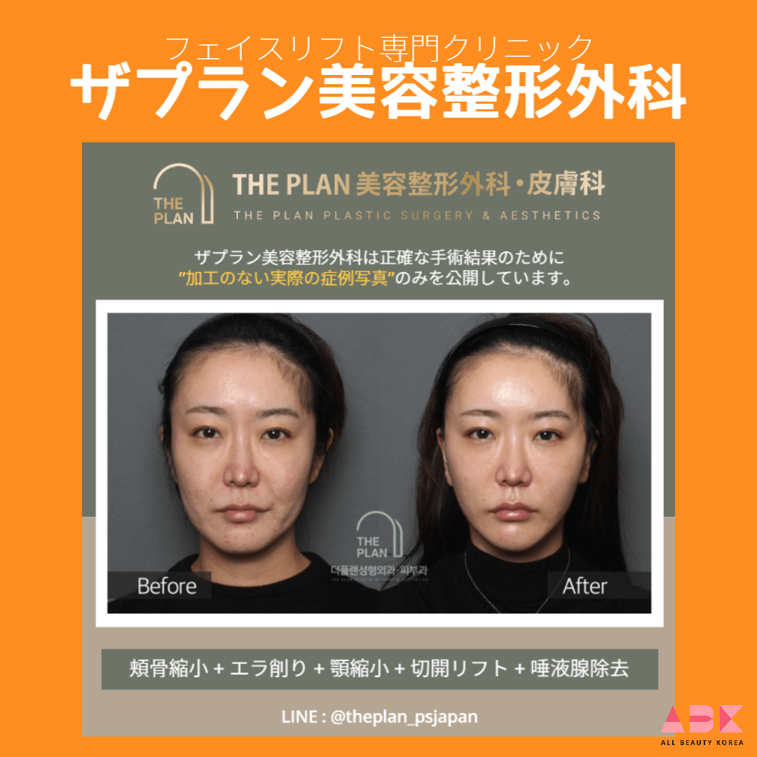 ザプラン美容整形外科, 症例写真