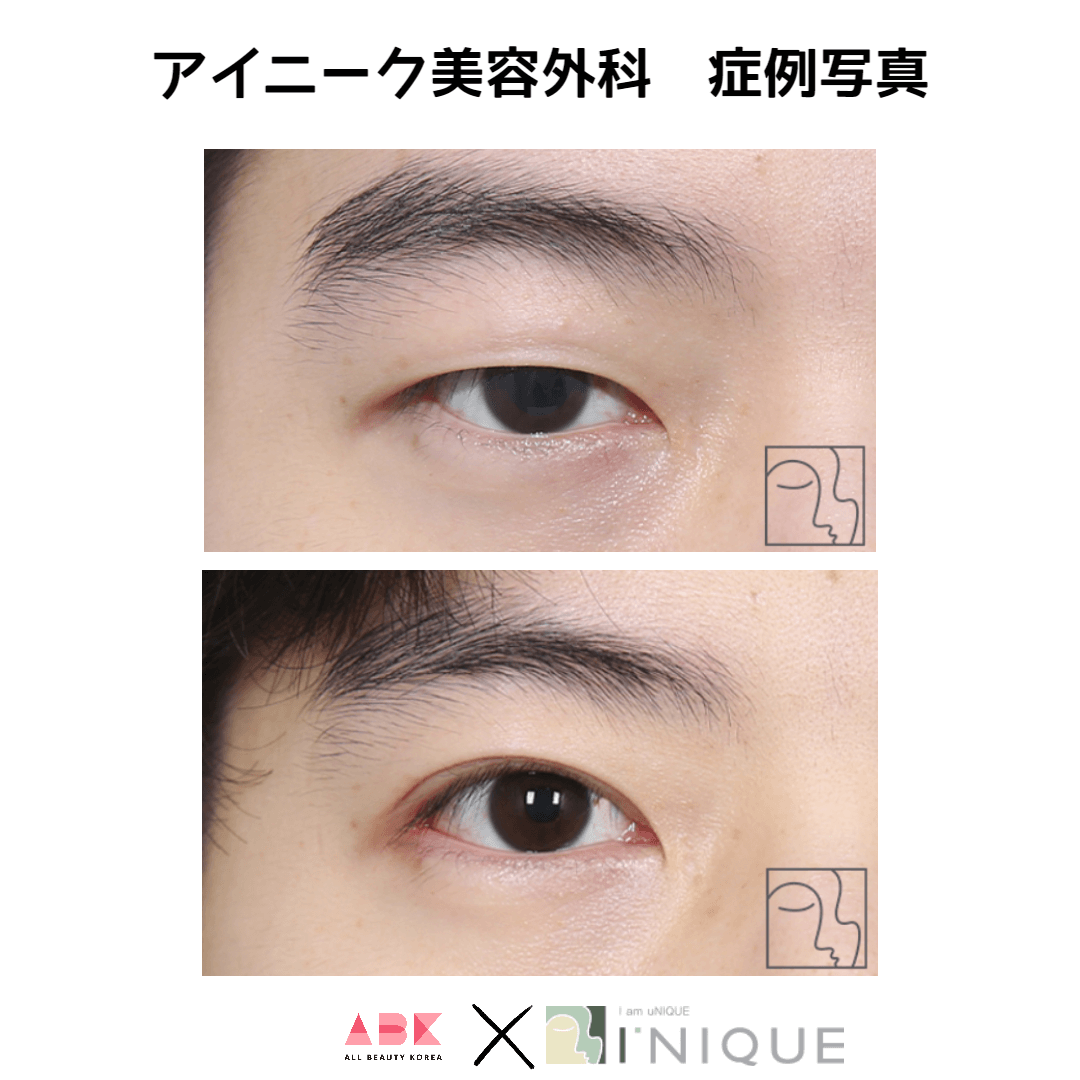 アイニーク美容外科,症例写真