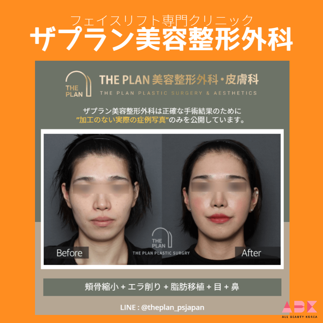 ザプラン美容整形外科, 症例写真