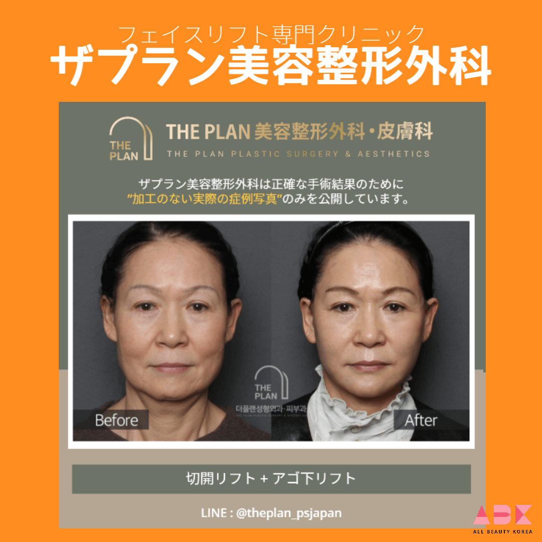 ザプラン美容整形外科, 症例写真