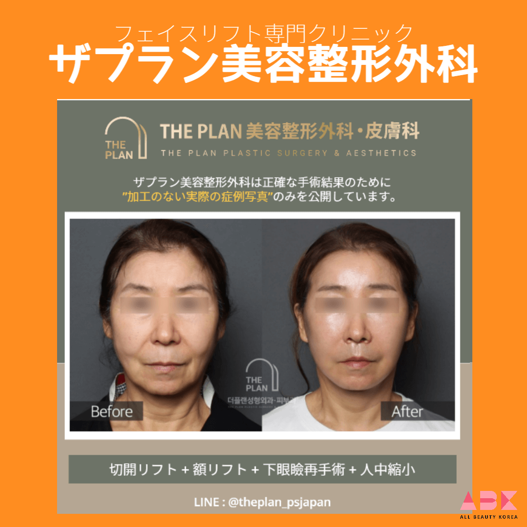 ザプラン美容整形外科, 症例写真
