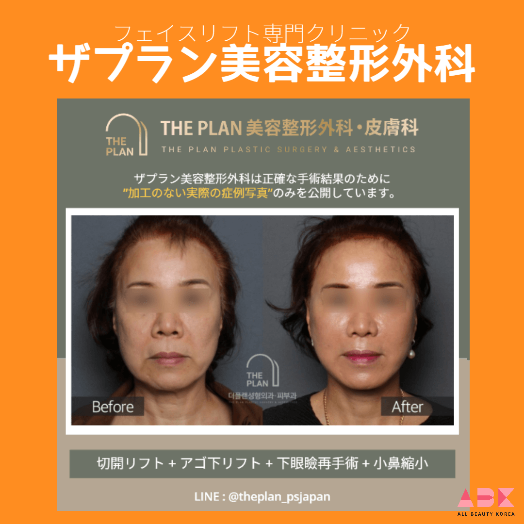 ザプラン美容整形外科, 症例写真
