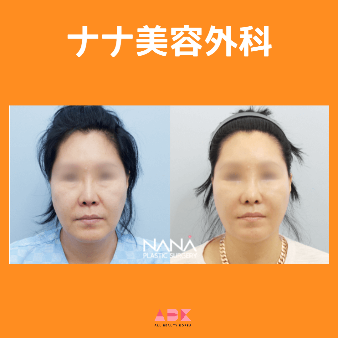 ナナ美容外科、症例写真