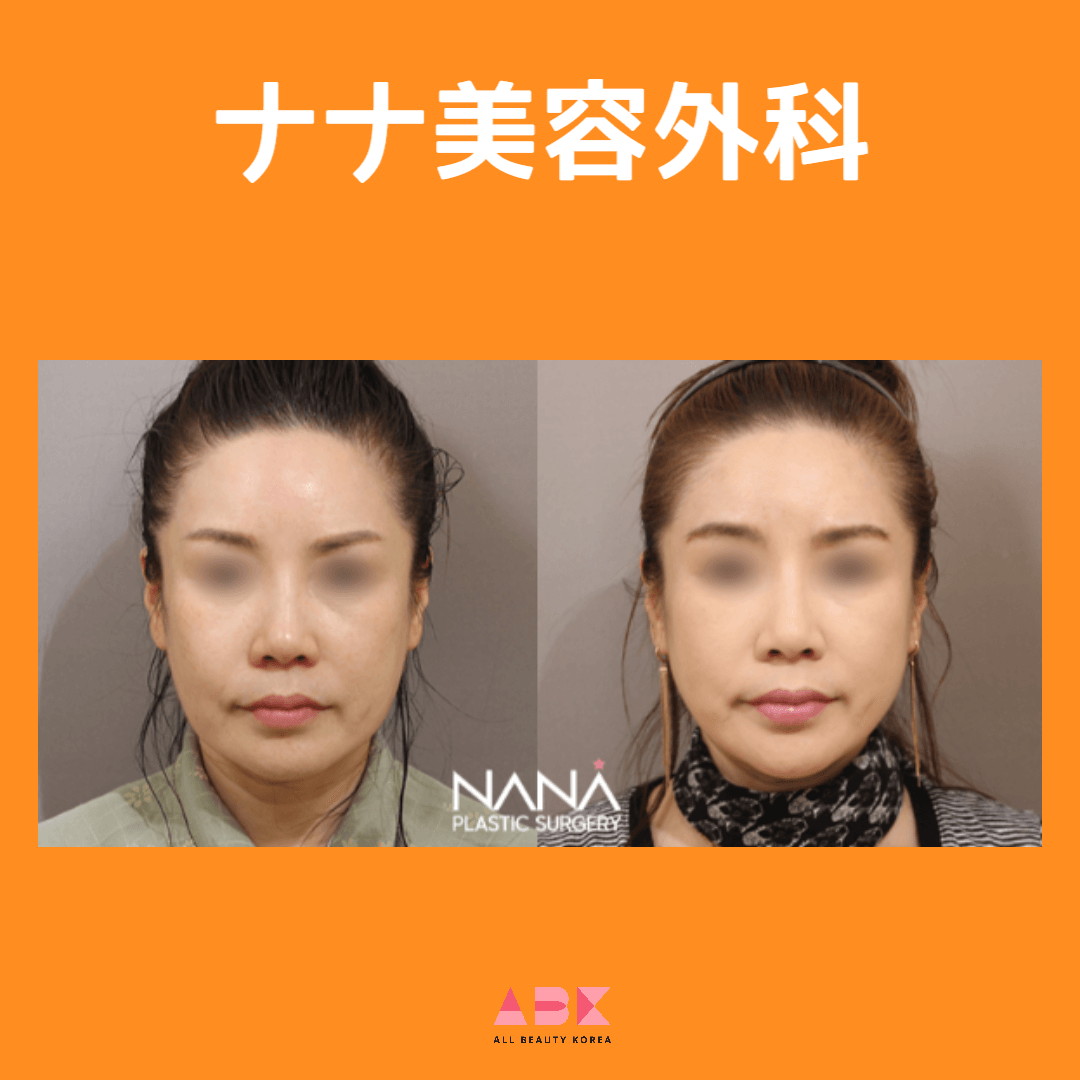 ナナ美容外科、症例写真
