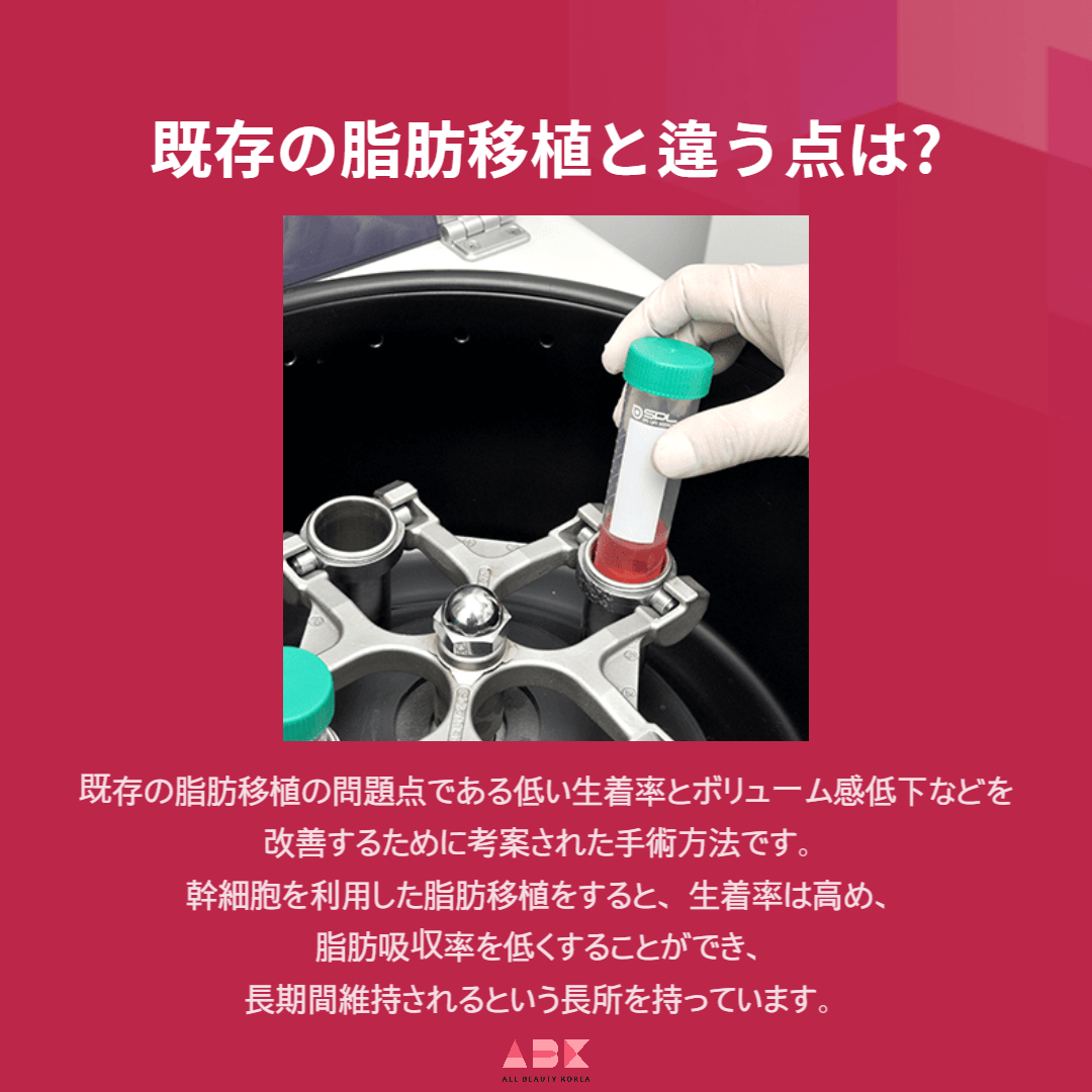 既存の脂肪移植と違う点は