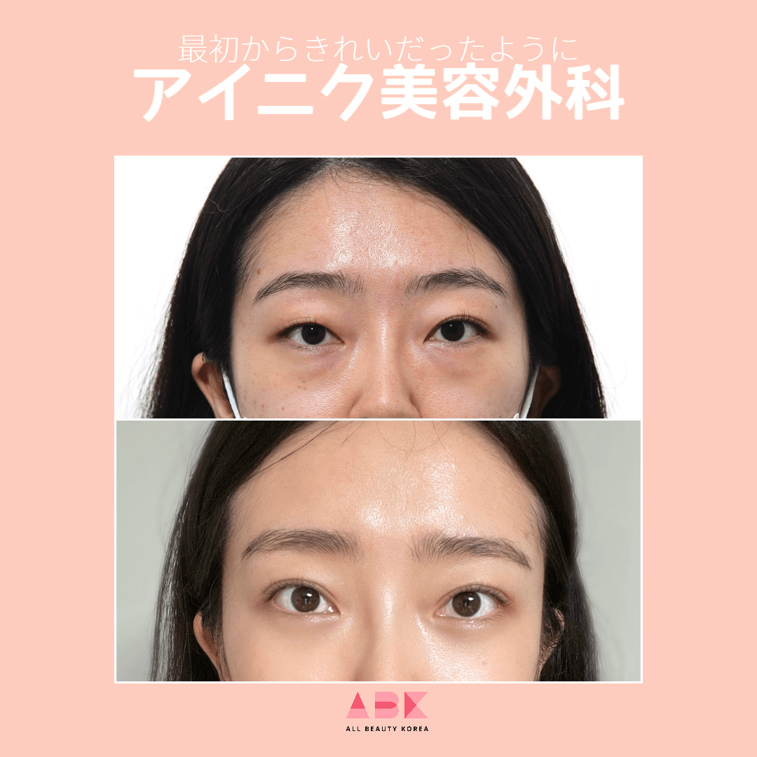 アイニク美容外科目整形 Before/After