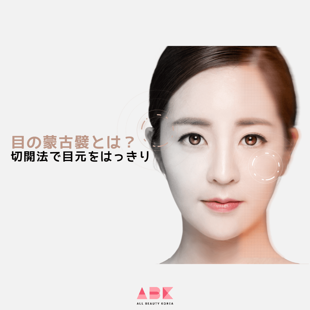 目の蒙古襞とは？切開法で目元をはっきり