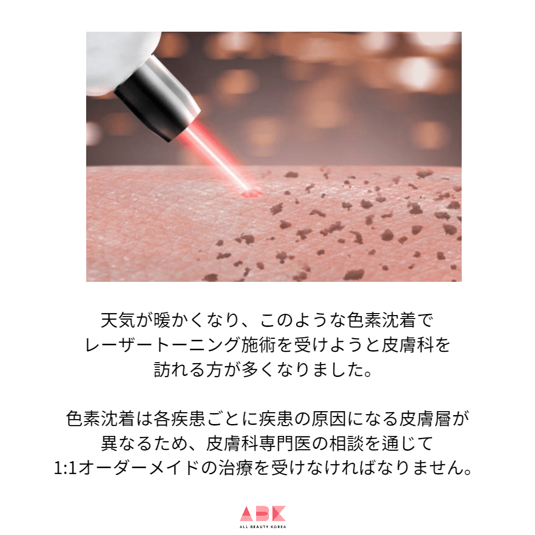 春にひどくなる色素沈着、レーザートーニングできれいに除去