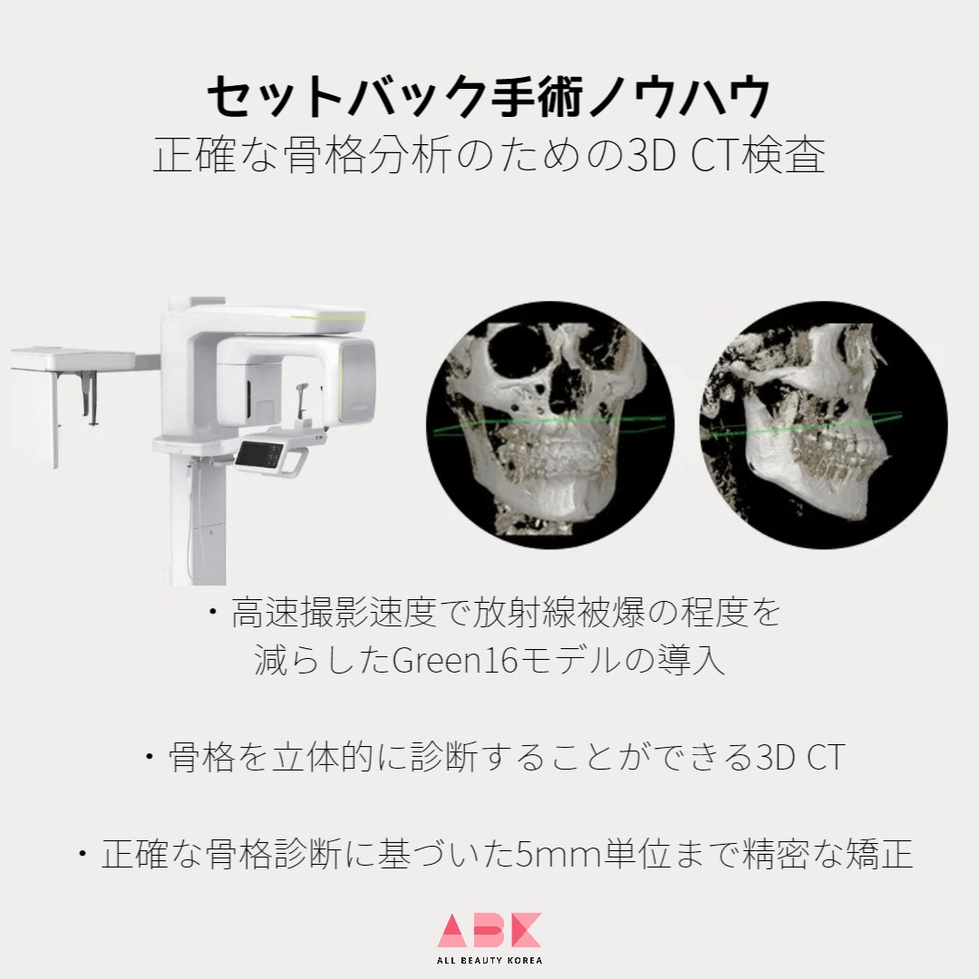 セットバック手術ノウハウ 3D CTを通じた正確な分析