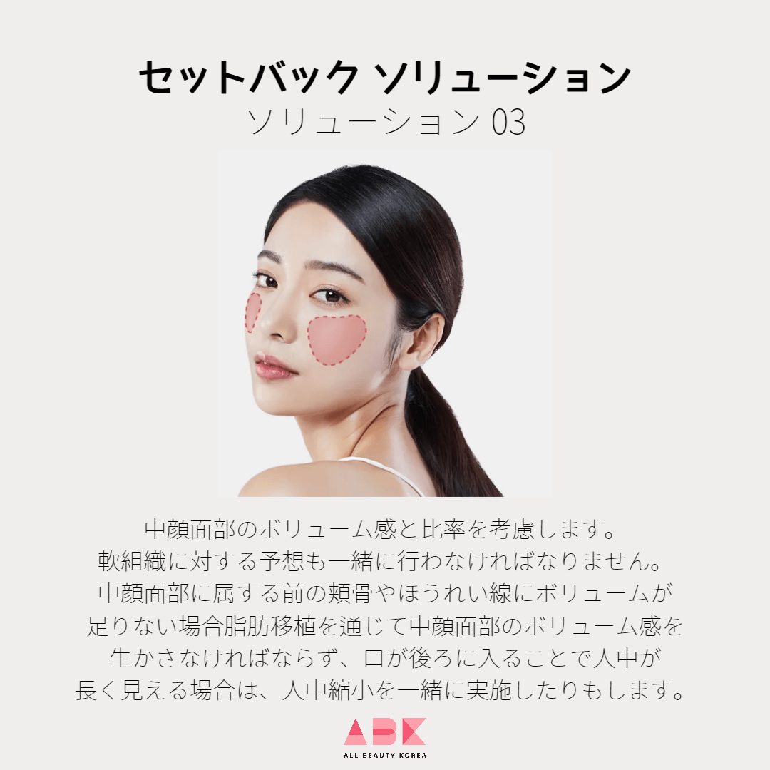 中顔面部のボリューム感と比率を考慮します。