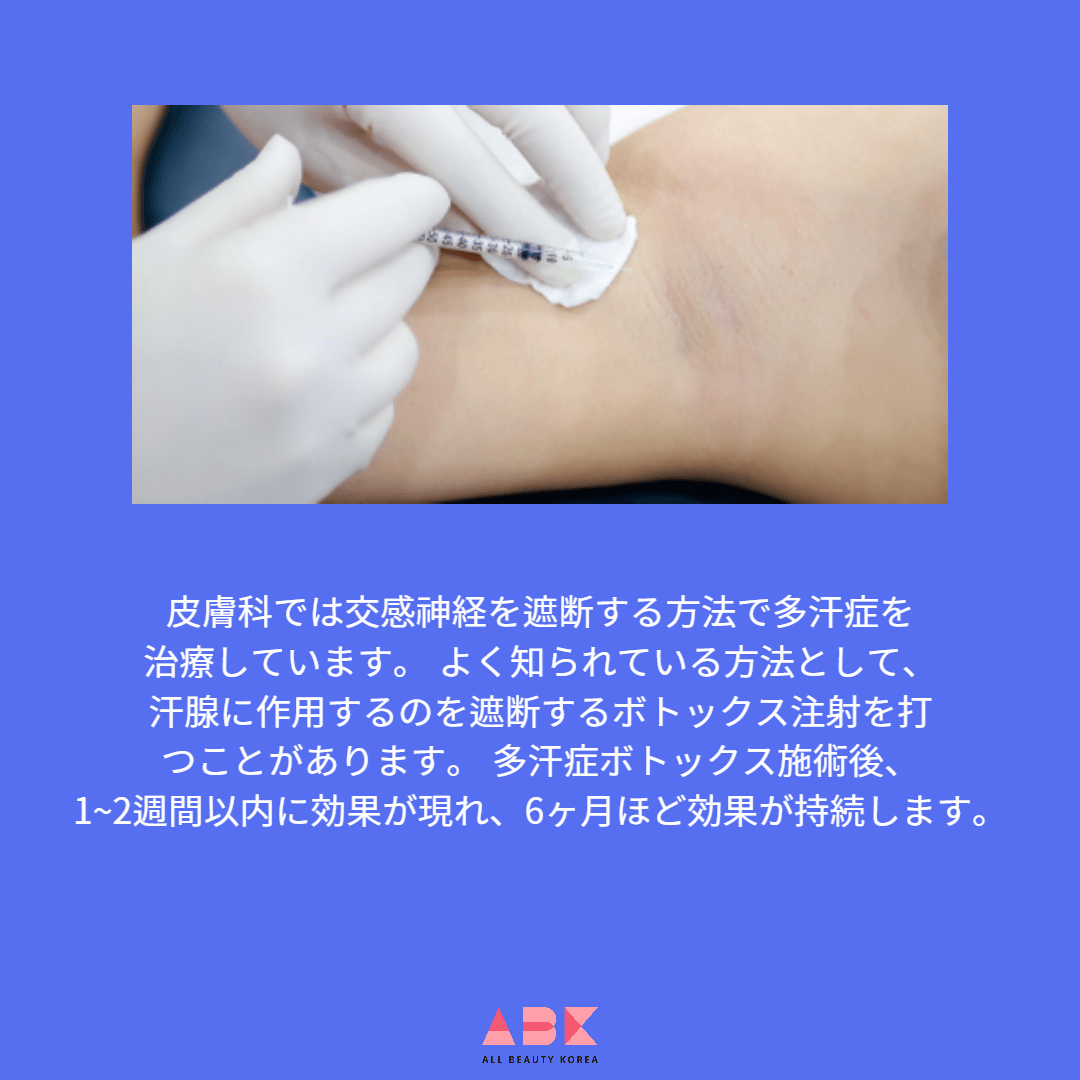 多汗症ボトックス施術後、1~2週間以内に効果が現れ、6ヶ月程度効果が持続します。