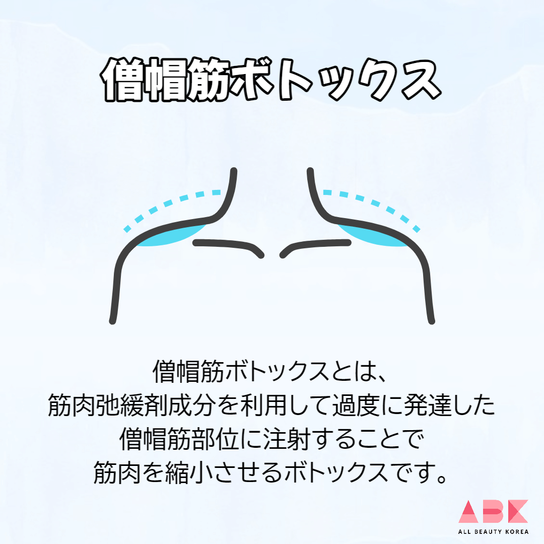 僧帽筋ボトックスとは