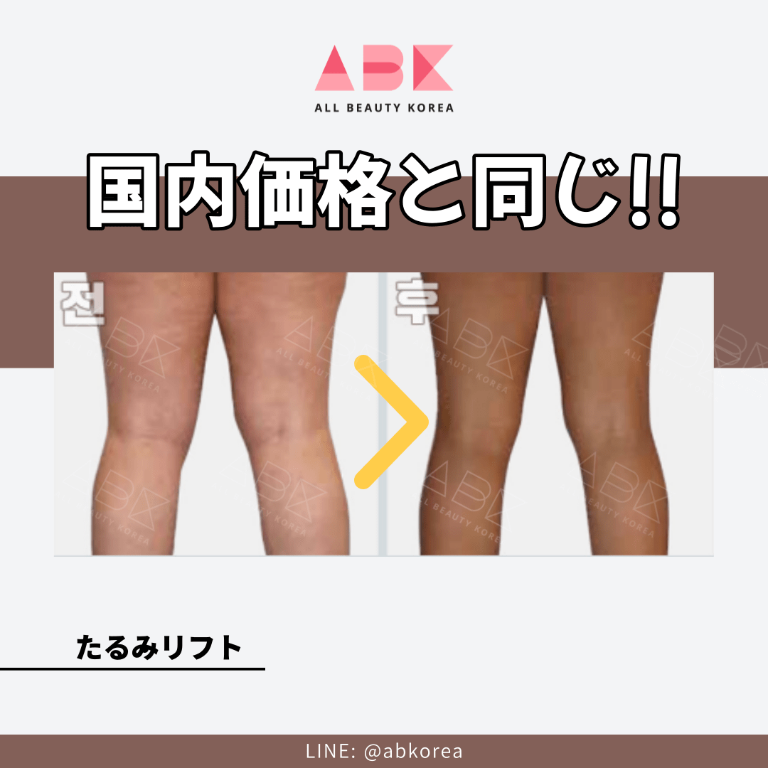 [MODS x ABK] ボディリフティング🩱 - 画像 (4)