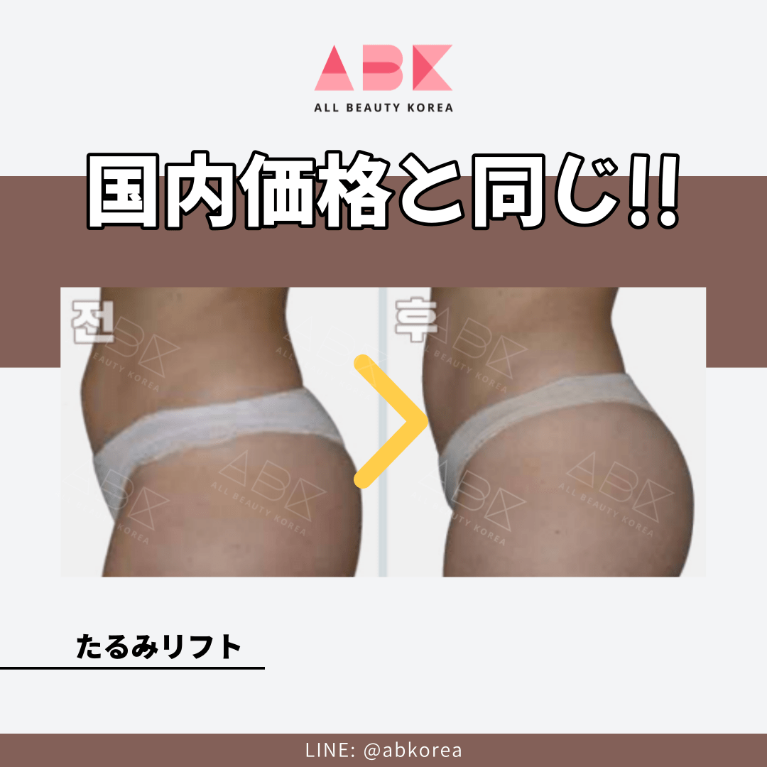 [MODS x ABK] ボディリフティング🩱 - 画像 (5)