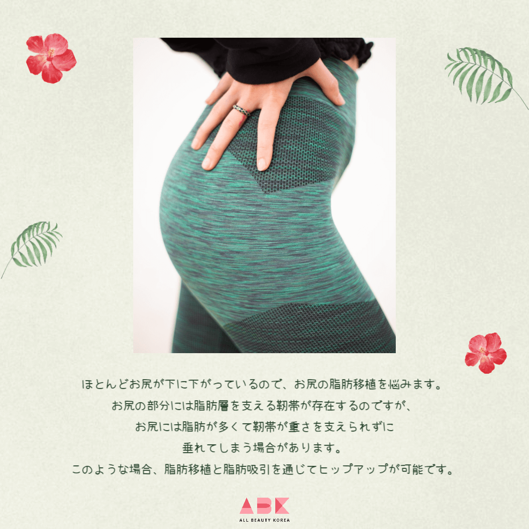 韓国ヒップアップ脂肪移植