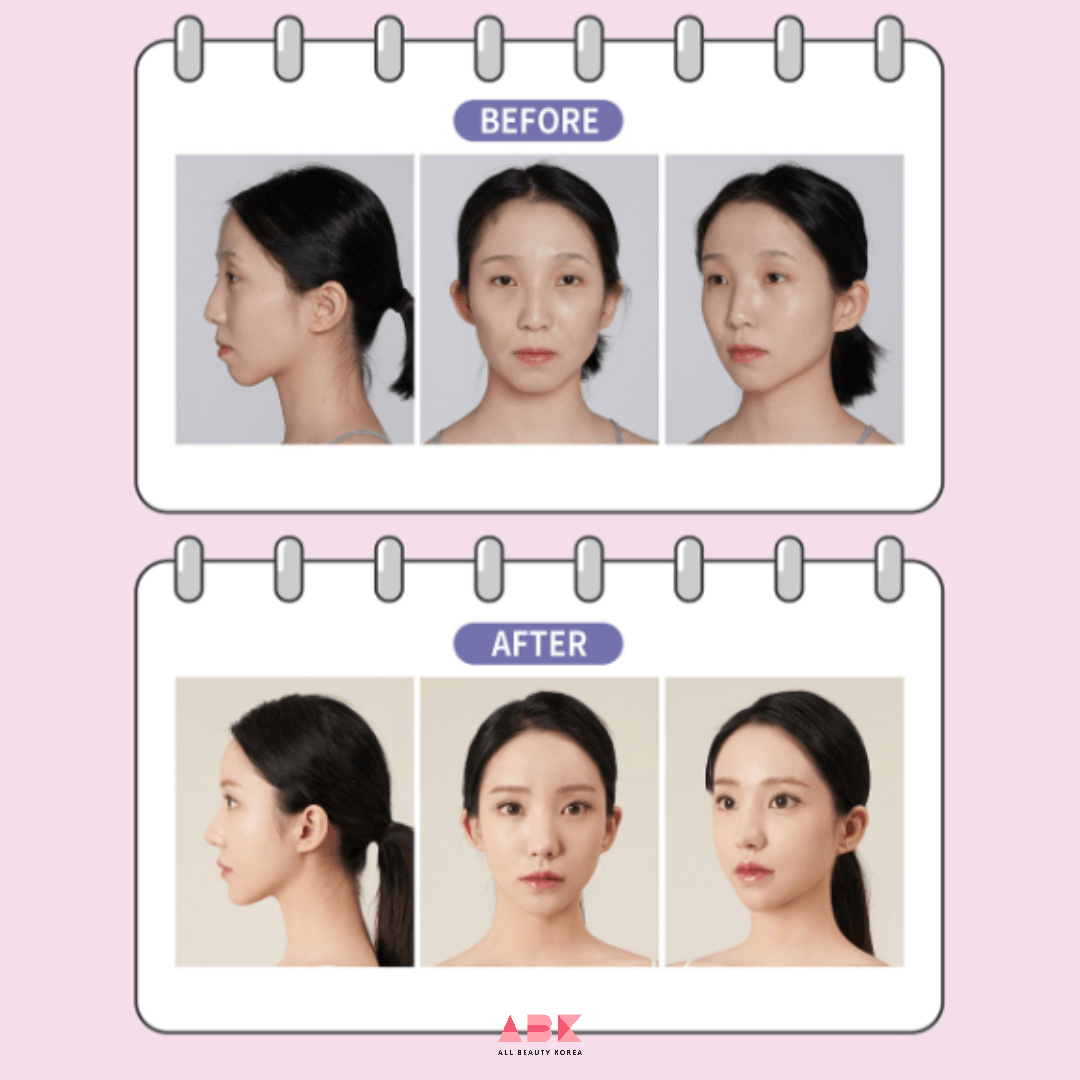 韓国美容整形のリアルストーリー