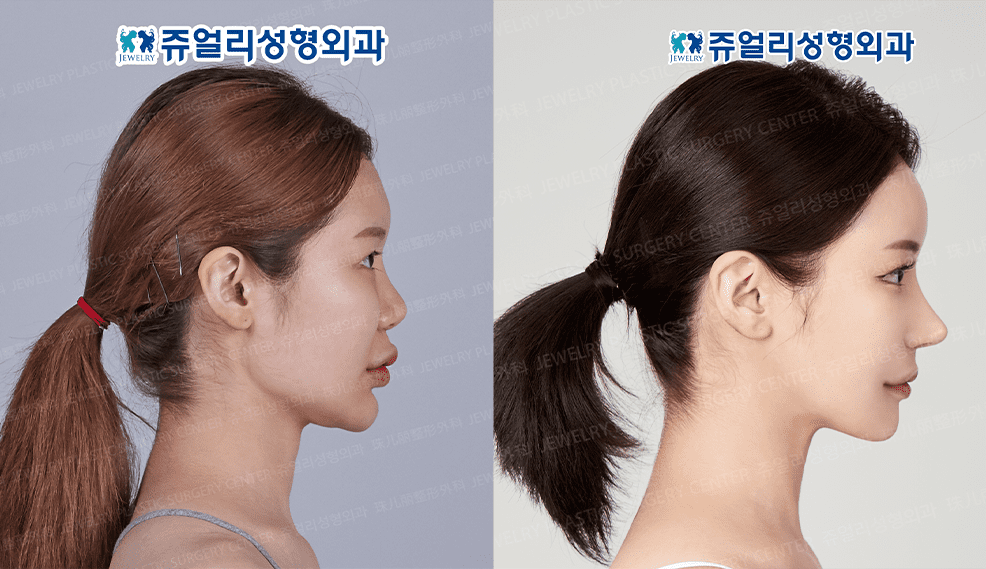 쥬얼리 눈 01
