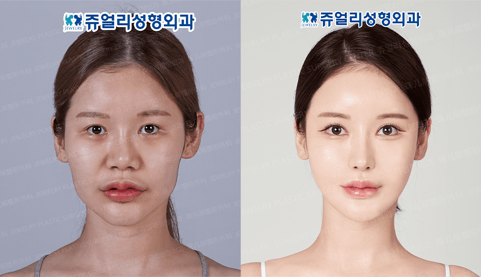 쥬얼리 눈 02