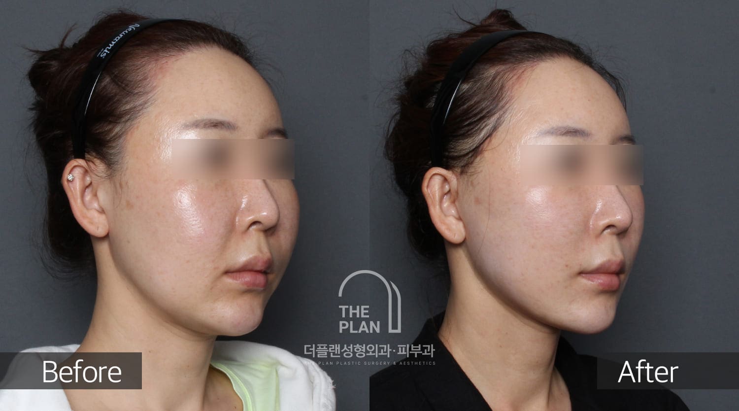 김문선-FL-2