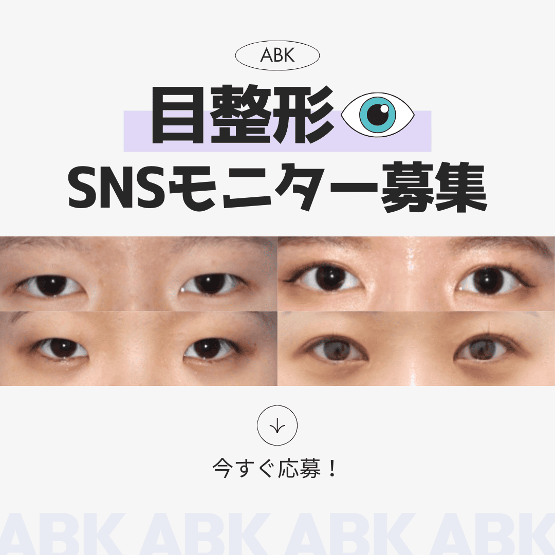 ABKの目整形SNSモニター募集の告知。画像には、施術前後の目元の比較が示されています。上段には施術前の写真、下段には施術後の写真が並んでいます。下部には「今すぐ応募！」のメッセージがあります。視覚的に引きつけるデザインになっています。