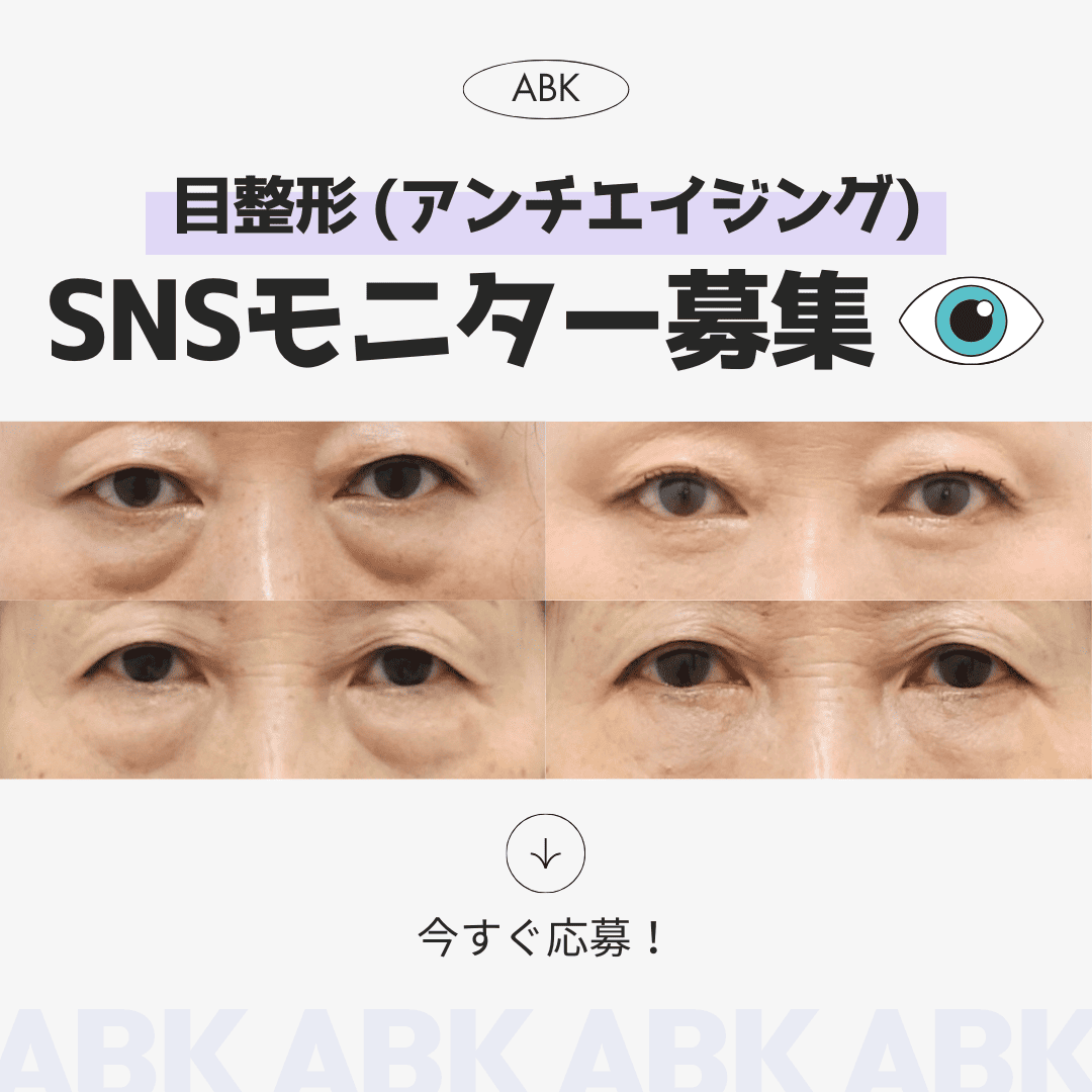 ABKの目整形（アンチエイジング）SNSモニター募集の告知。画像には、施術前後の比較が示されています。上段には施術前の目元の写真が、下段には施術後の目元の写真が配置されています。下部には「今すぐ応募！」のメッセージがあり、視覚的に引きつけるデザインがされています。