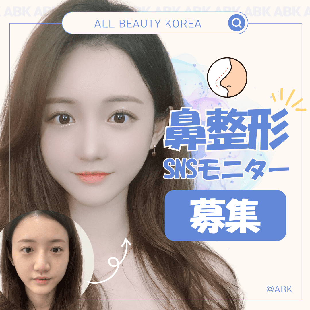 ABKの鼻整形SNSモニター募集の告知。画像の上部には、「鼻整形」というタイトルとともに、モニター募集の文言があります。左下には施術前の写真があり、右側には施術後の理想的なイメージが表示されています。全体的に明るく親しみやすいデザインになっています。