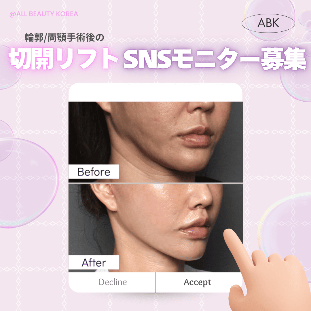 ABKの切開リフトSNSモニター募集の告知。左側に施術前（Before）、右側に施術後（After）の画像が表示されています。下部には「Decline」と「Accept」の選択肢があります。全体的に柔らかいデザインで、目を引く色合いが使われています。