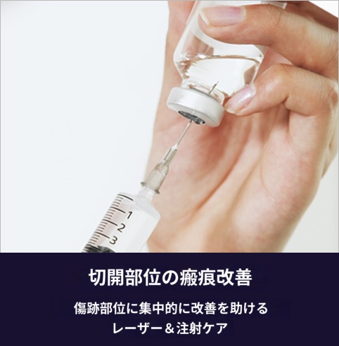 切開部位の傷跡改善
