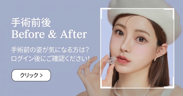 BEFORE&AFTER