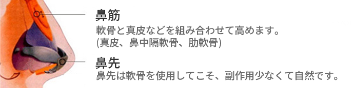 KOKO美容外科での鼻整形について鼻筋と鼻先の手術方法を簡単に表した図。