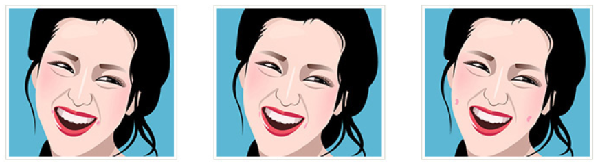 えくぼ整形の種類です。 長いえくぼは可愛くて優しい印象と共に成熟したイメージを与えます。 インディアンえくぼは子供のような無邪気さと腕白のイメージを与えます。 口角のえくぼは可愛くてつんと澄ましている感じと共に、キュートなイメージを与えます。 頬の真ん中のえくぼは童顔に見え、可愛くて柔らかい印象を与えます。