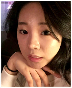 ココ美容外科リアルモデルの正面自撮り写真です。 右手の手の甲であごを支えて眺めています。