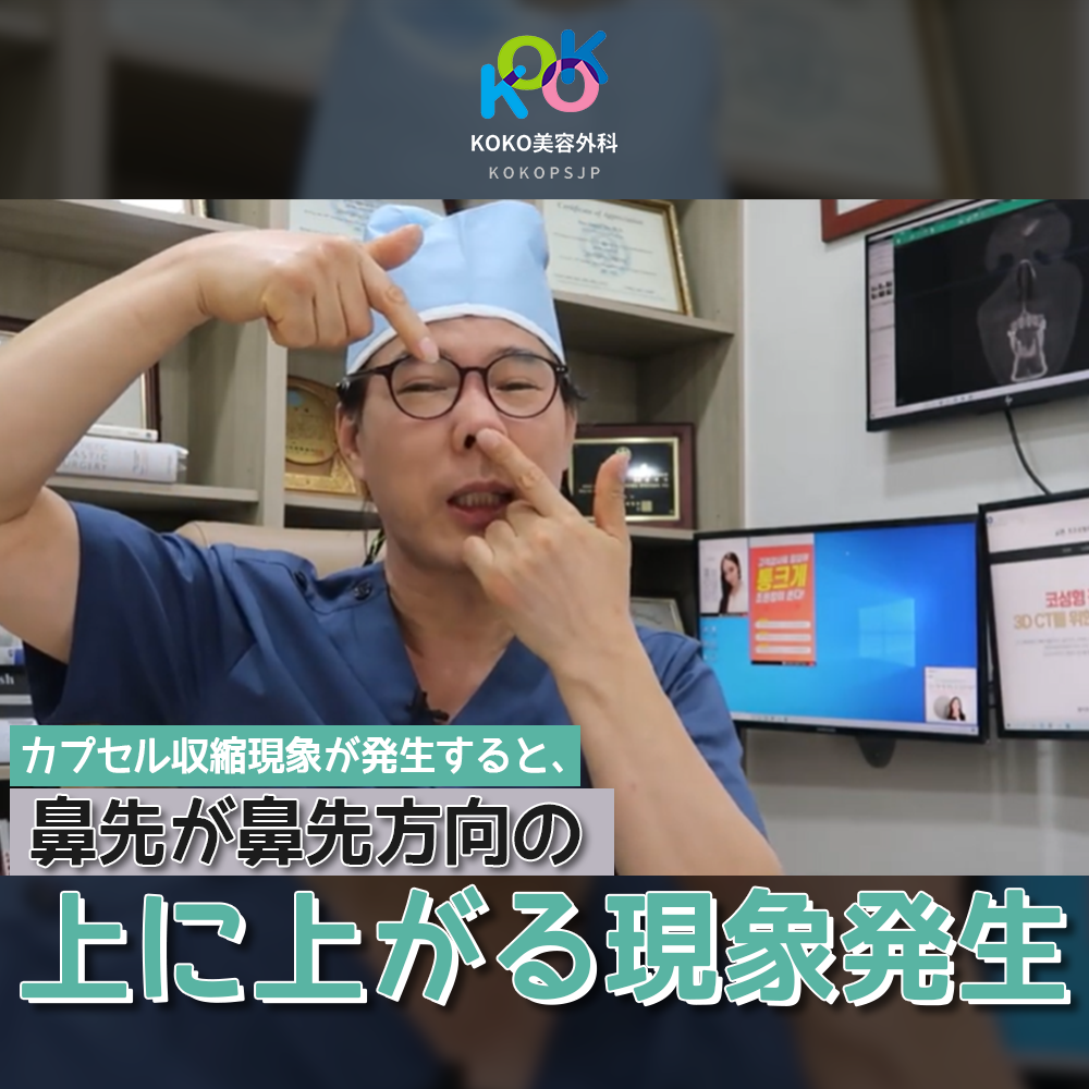 つまり、一般的に知られている単純な炎症ではなく、「無菌状態で炎症が起こる場合」も発生します。 シリコンがカプセル収縮現象が起こると、鼻先が鼻筋方向の上に上がる現象が発生します。