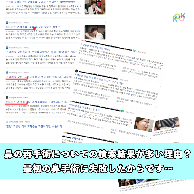 ココ美容外科で鼻の手術をしなければならない理由