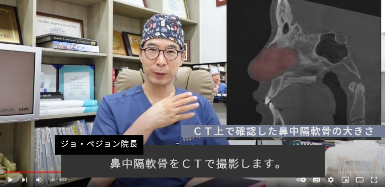 鼻整形時に最も重要な診断をCTで行うので正確な診断が可能!
