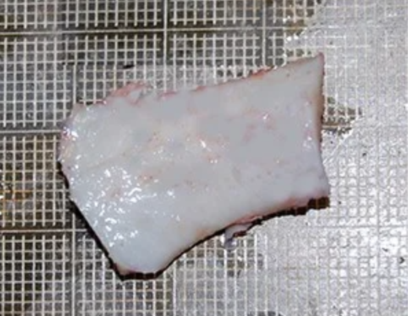 A real image of how a costal cartilage being cut looks like