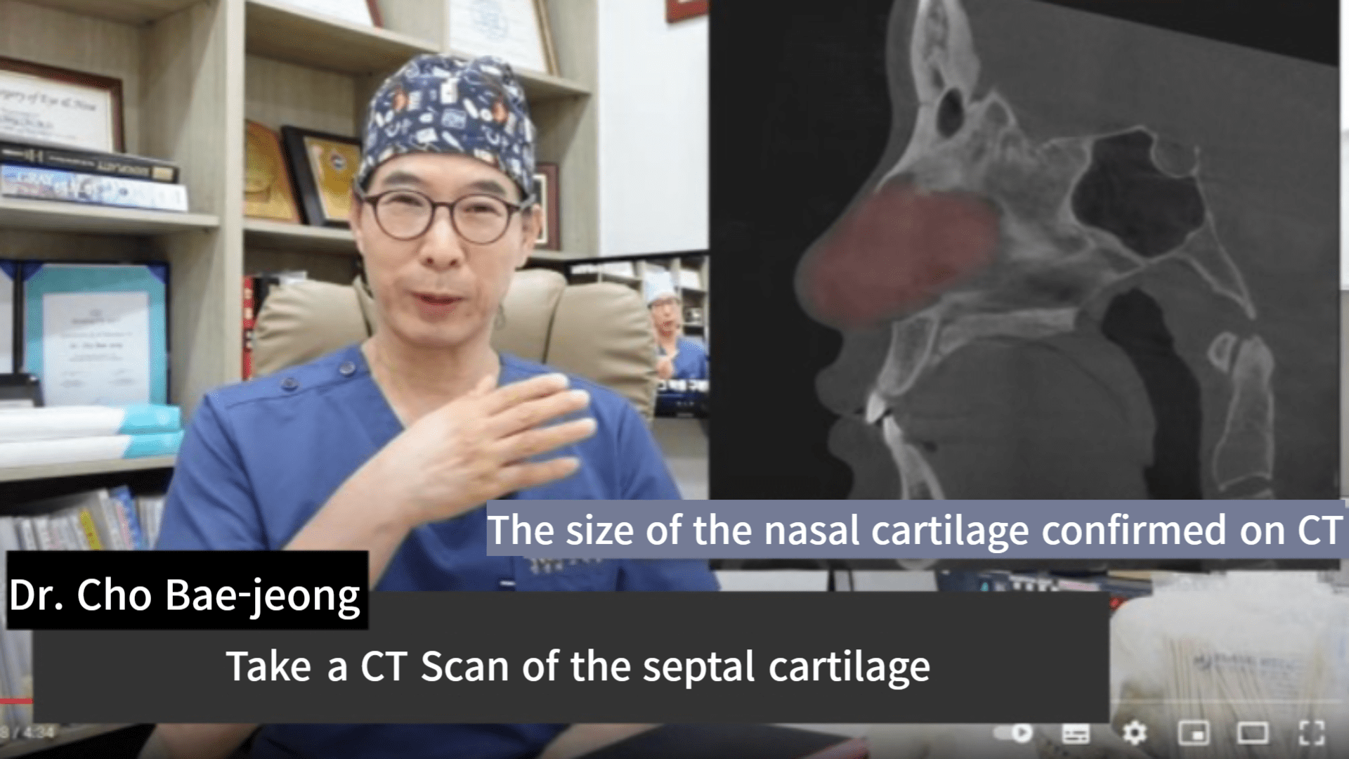 Accurate diagnosis is possible because the most important diagnosis is through CT Scan