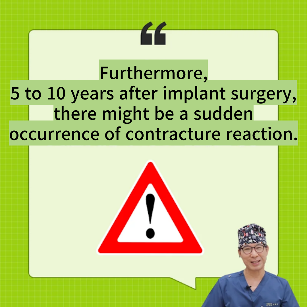 rhinoplasty with implants