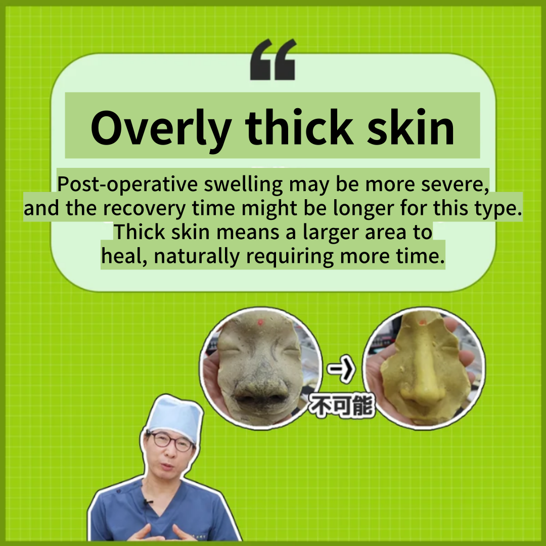 rhinoplasty with different outcomes