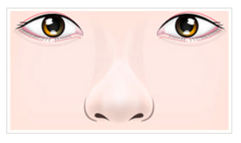 [KOKO美容外科] 団子鼻矯正について | Korea's Top Nose Revision Specialist