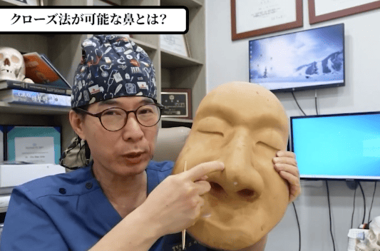 KOKO美容外科:オープン法とクローズ法の比較で理想の鼻整形