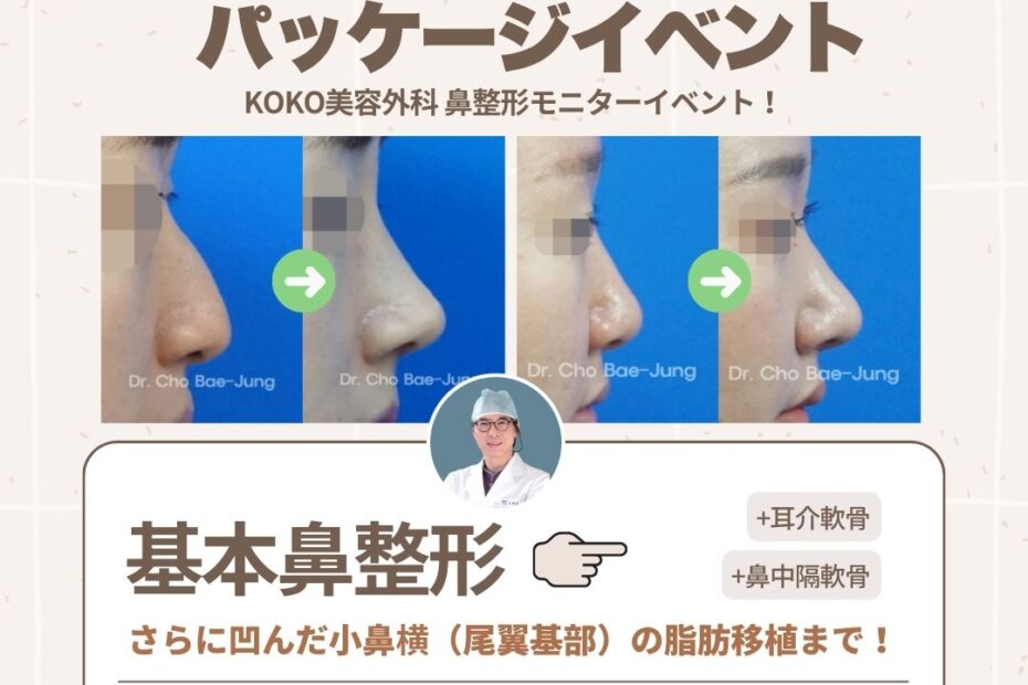 狎鴎亭最初の鼻専門クリニック「KOKO美容外科」による韓国鼻整形特価パッケージイベントの広告画像。チョ・ベジョン代表院長の顔写真と、鼻整形のビフォーアフター症例写真が含まれている。イベント内容は、基本鼻整形に加え、耳介軟骨と鼻中隔軟骨の使用、さらに凹んだ小鼻横(尾翼基部)への脂肪移植まで含んだ「鼻フル」セット。価格は350万ウォンから。医療タックスリファンド(税金還付)も12月まで対象。25年の経験と技術を持つ専門医による執刀。LINE無料相談IDは @kokopsjp 。