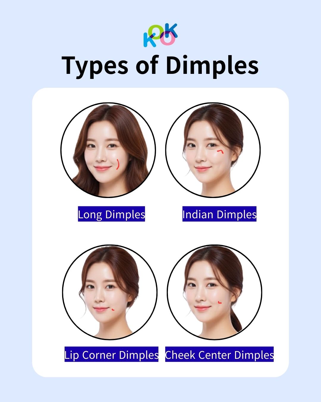 An educational guide showing four different types of dimples common in Korean plastic surgery procedures. The diagram illustrates: Long Dimples: A vertical line on the mid-cheek. Indian Dimples: Located horizontally under the eyes/top of the cheekbones. Lip Corner Dimples: Small accents right next to the mouth. Cheek Center Dimples: Classic circular indentations in the middle of the cheek.