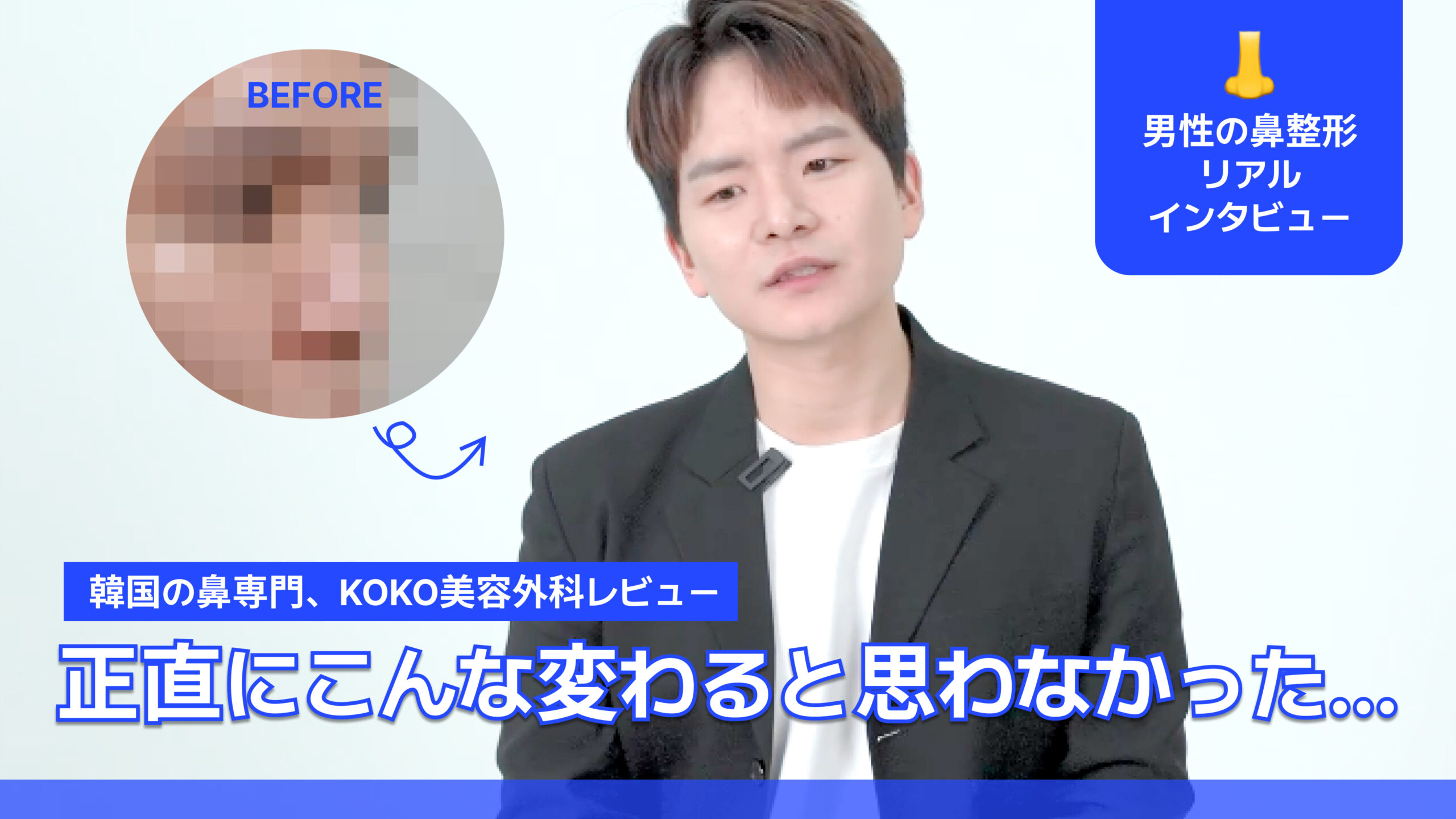 韓国鼻整形で人生激変!低い鼻・アップノーズ改善体験談 | 韓国鼻整形名医