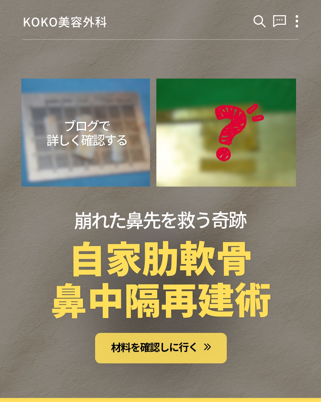 韓国鼻整形の再手術|自家肋軟骨で安全に鼻中隔再建 | 韓国鼻整形